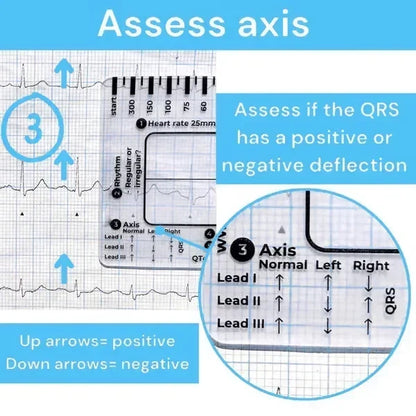 MediTrack – Professional ECG Assessment Pocket Guide – image 5