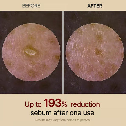 SkinAura – Mild Exfoliating Black Rice Ampoule Serum – image 9