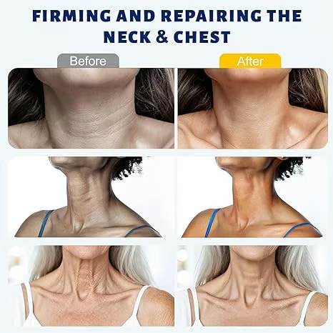 DermaRoll Neck – Sculpting Lift Cream – image 2