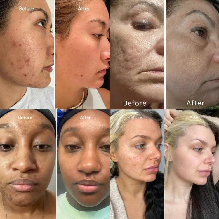 DermaRoll Neck – Sculpting Lift Cream – image 3