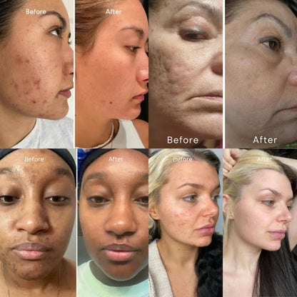 DermaRoll Neck – Sculpting Lift Cream – image 3