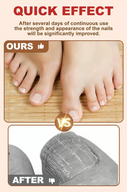 BeautyTips – Nail Repair – image 4