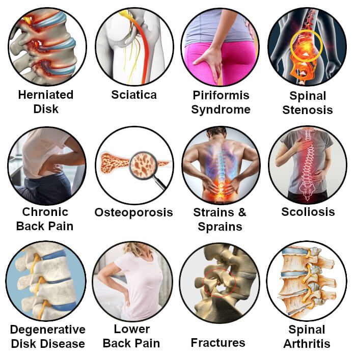 MagnaSpine – Orthopedic Magnetic Support Belt – image 15