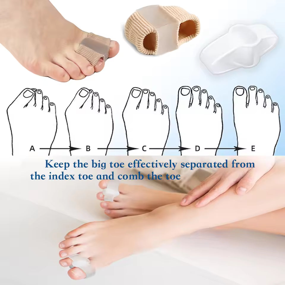 ToeAlign – Bunion Corrector System – image 5