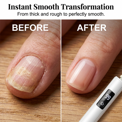 FlawlessTouch – Nail Drill & Buffing System – image 3