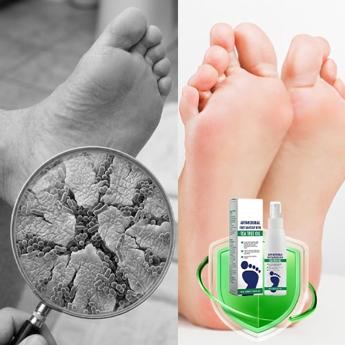 DryStep – Sweat Control Foot Care Spray – image 4