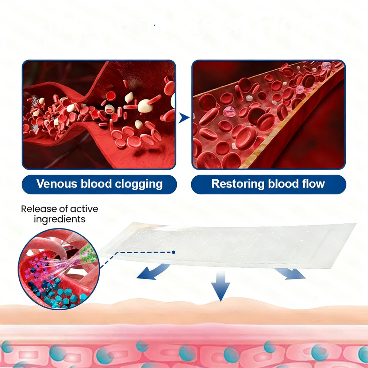 LegEase – Comfortable Vein Care Patch System – image 9